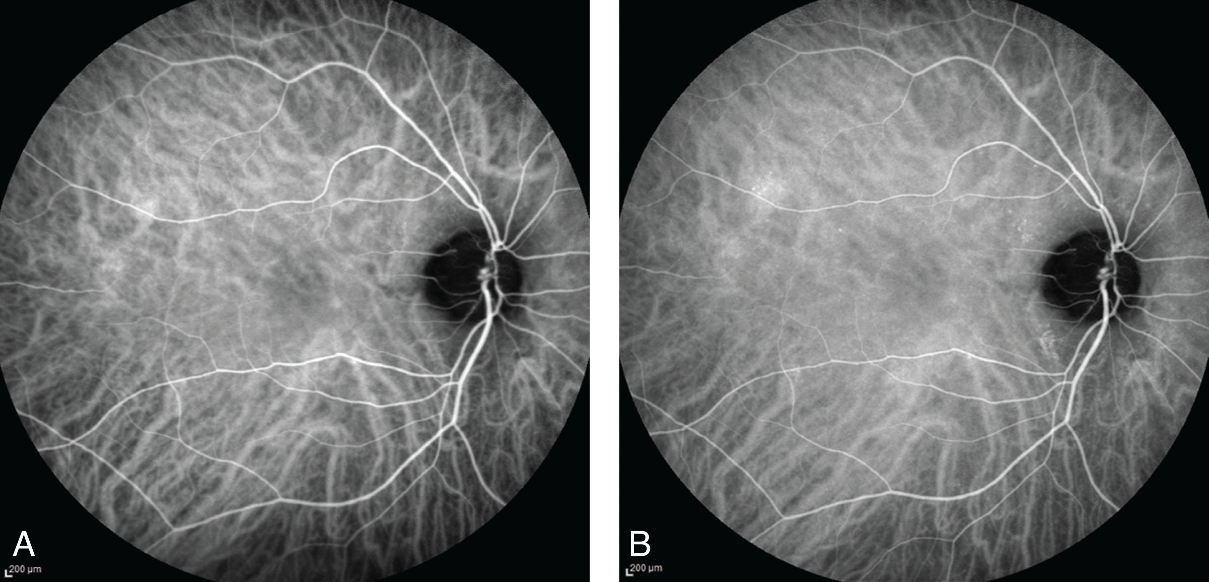 Examination Of The Eye | Ento Key