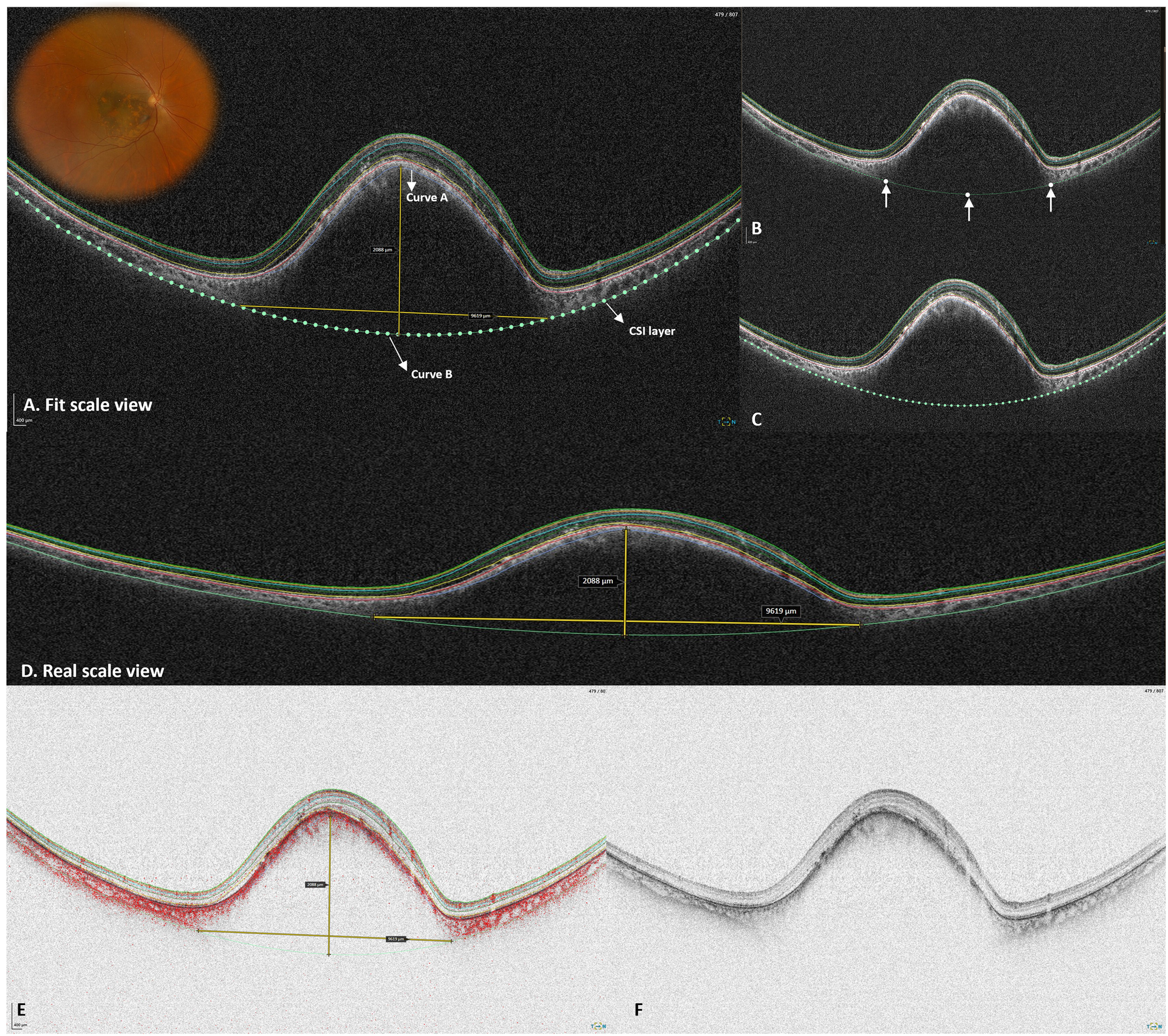 FIGURE 1 dummy alt text