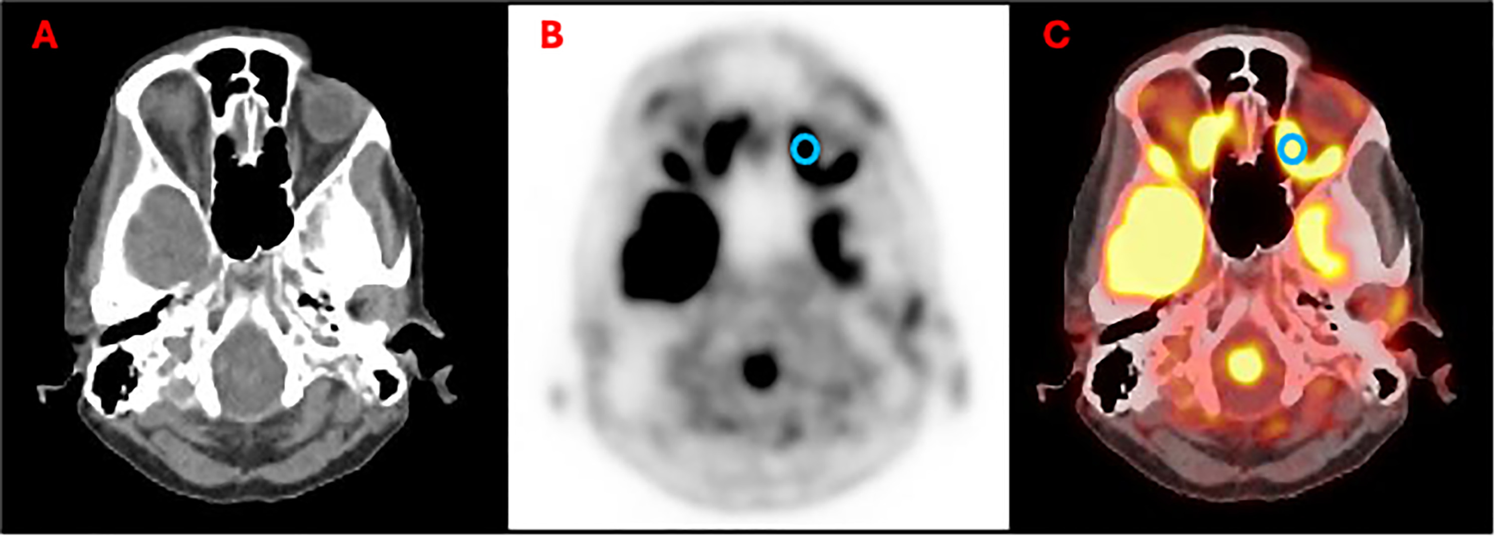 FIGURE 1: dummy alt text